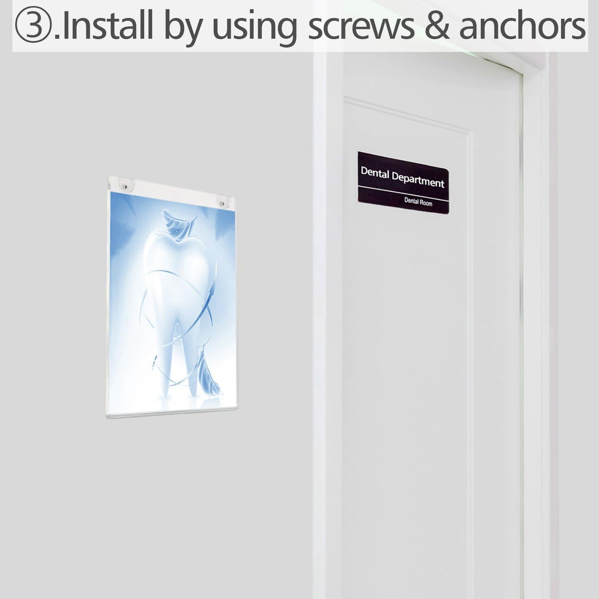 Screws